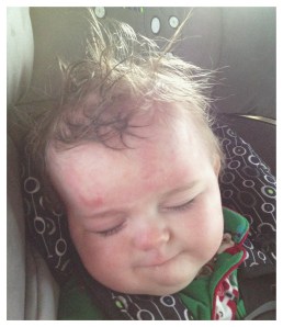 Headed home after his two-day EEG. Too bad he can't open his eyes to see his awesome hair.