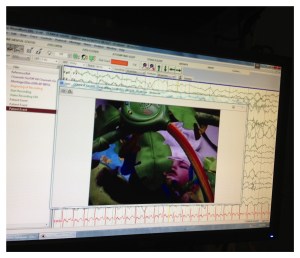 Video EEG screen