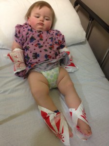 Heat packs to bring out the veins.